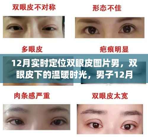 男子雙眼皮恢復之旅，冬季溫暖時光與友情的碰撞