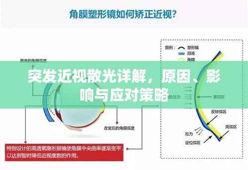 突發近視散光詳解，原因、影響與應對策略