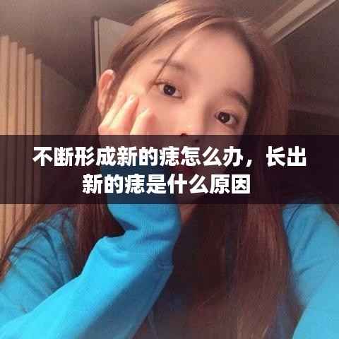 不斷形成新的痣怎么辦，長出新的痣是什么原因 