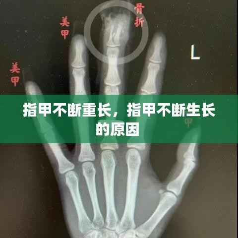 指甲不斷重長，指甲不斷生長的原因 