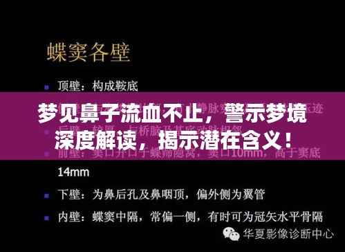夢見鼻子流血不止，警示夢境深度解讀，揭示潛在含義！
