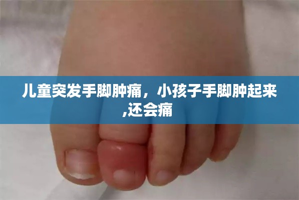 兒童突發手腳腫痛，小孩子手腳腫起來,還會痛 