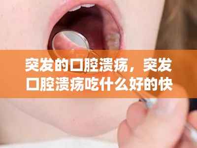 突發(fā)的口腔潰瘍，突發(fā)口腔潰瘍吃什么好的快 