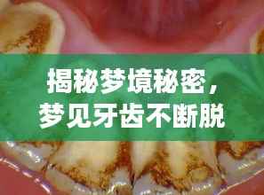揭秘夢境秘密，夢見牙齒不斷脫落的背后含義