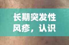 長期突發性風疹，認識、預防與治療全攻略