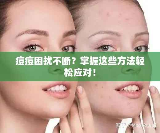 痘痘困擾不斷？掌握這些方法輕松應對！