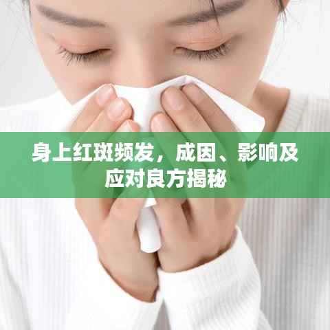 身上紅斑頻發，成因、影響及應對良方揭秘