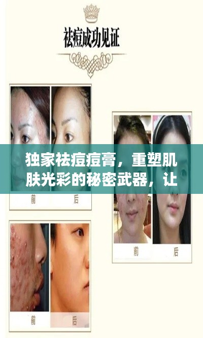 獨家祛痘痘膏，重塑肌膚光彩的秘密武器，讓你擁有無瑕美肌！